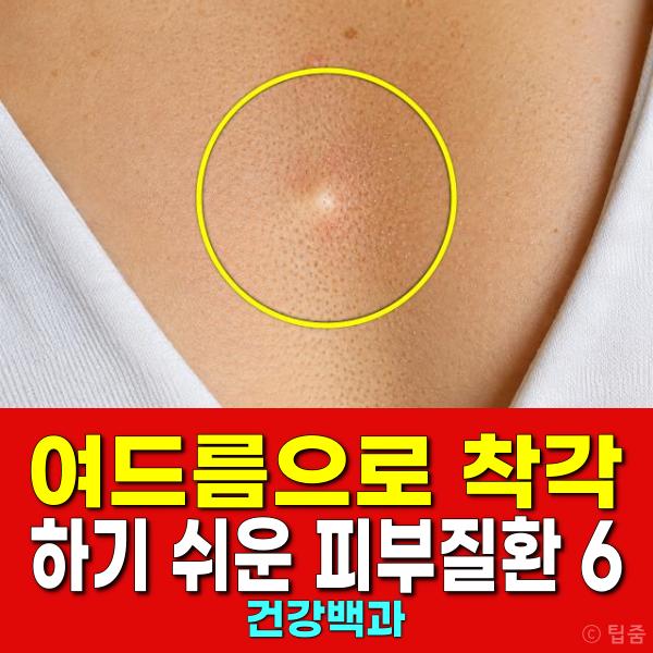 여드름 피부질환
