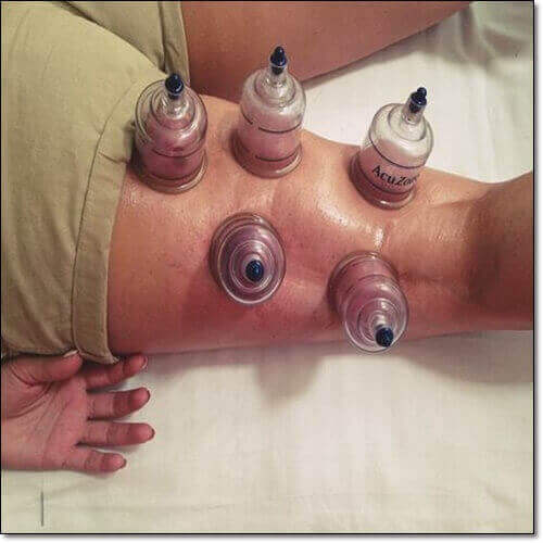 급성구획증후군 치료