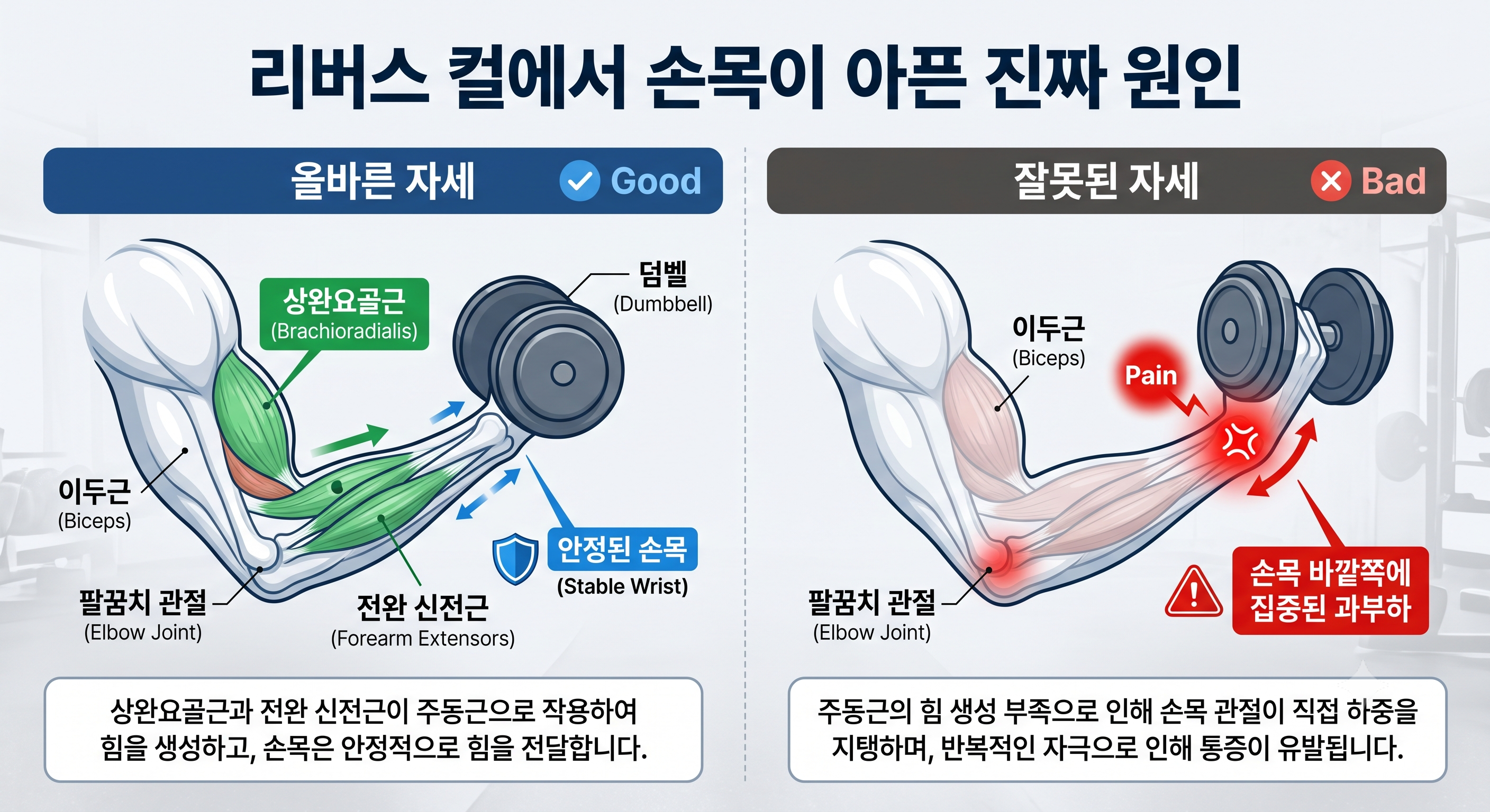 리버스 컬에서 손목이 아픈 진짜 원인