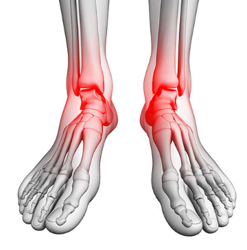 양쪽 발목 통증
