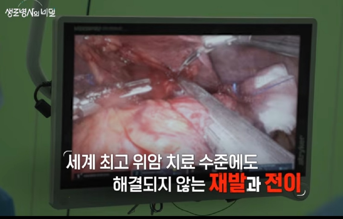 위암보고서-재발과-전이