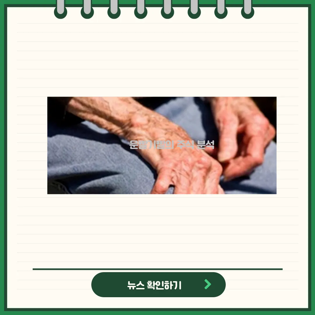 네이처셀 뉴스
