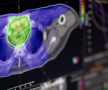 중입자 암 치료1