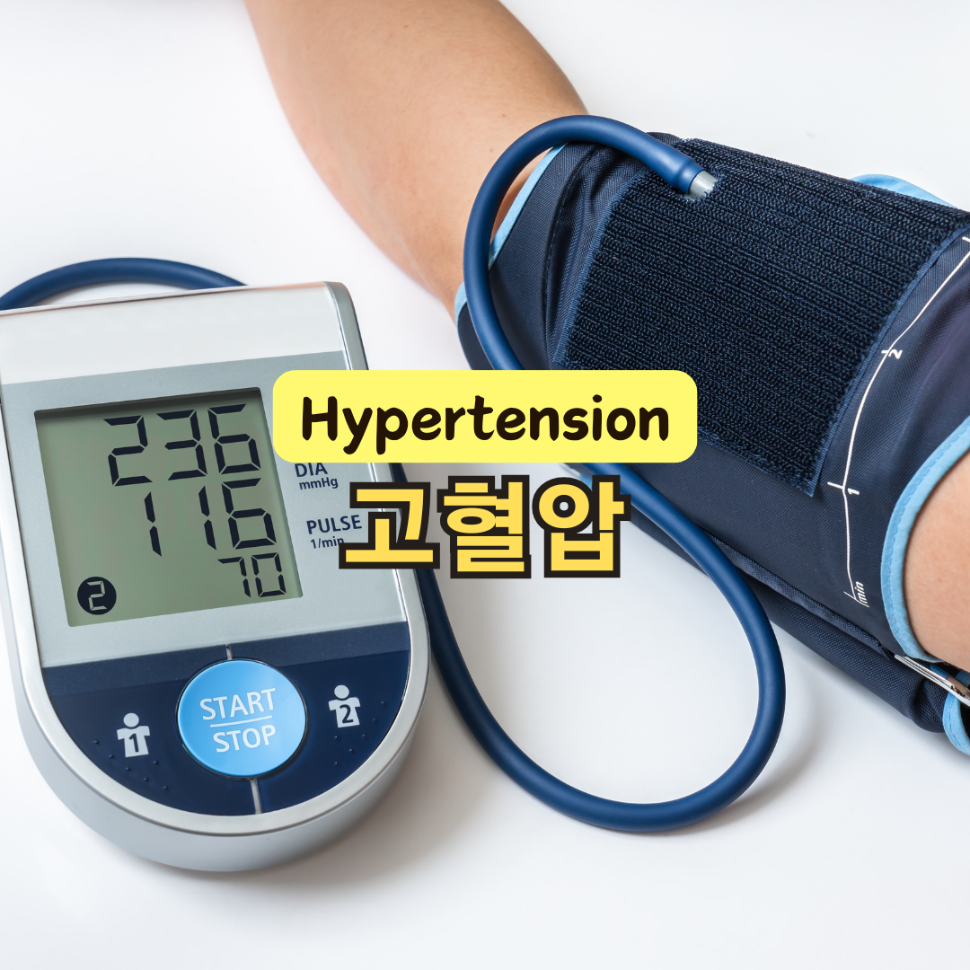 고혈압 낮추는 방법과 혈압 낮추는 음식 알아보기