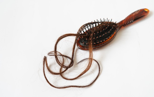 하루 몇 개까지 빠지면 탈모일까?