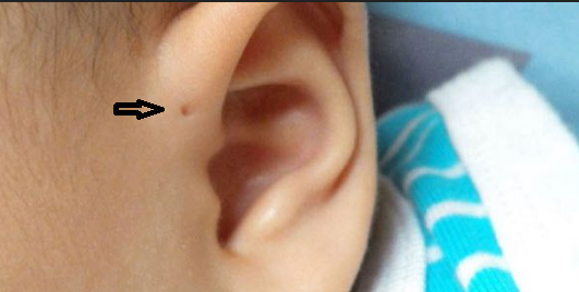 이루공-생긴-귀