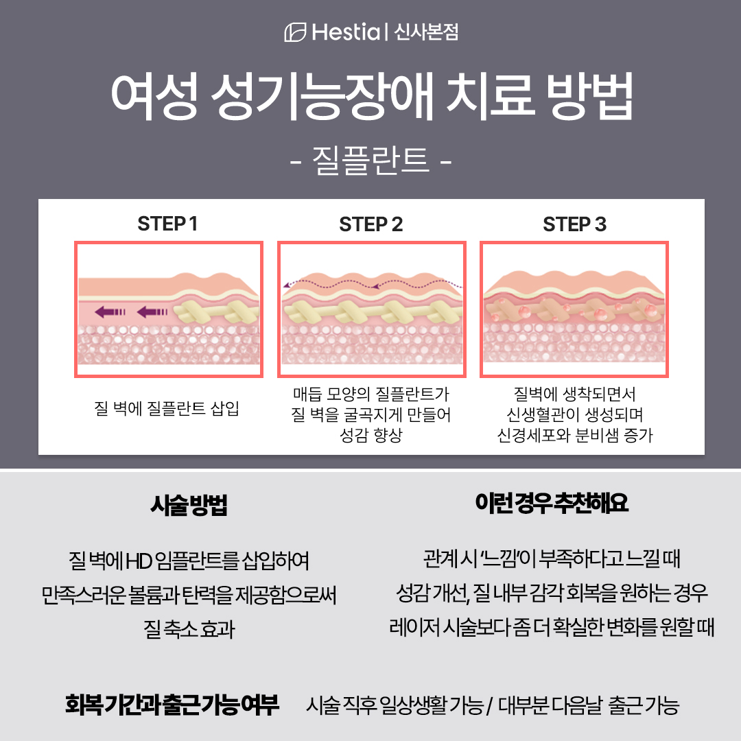 여성 성기능장애 치료 방법 -질플란트-