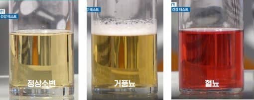 소변 색깔로 보는 건강