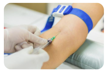 CRP 정상 수치 범위