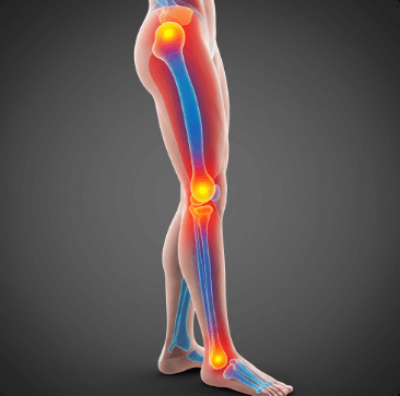 다리 저림 원인 및 해결법7