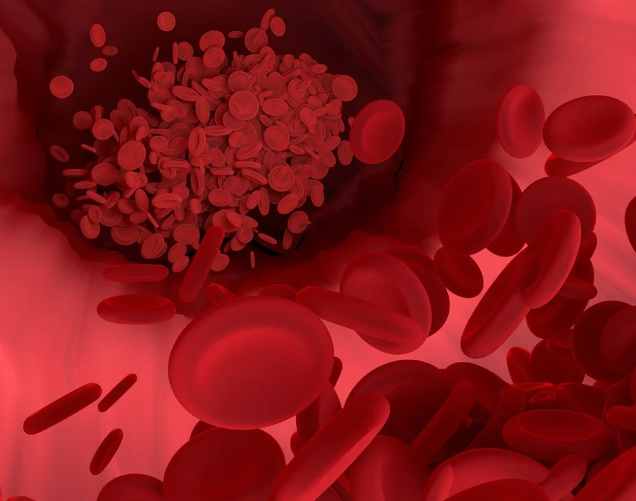 수족냉증 원인과 증상에 따른 관리방법