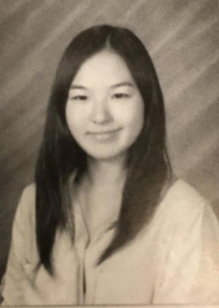 웬디 성형 성형 전