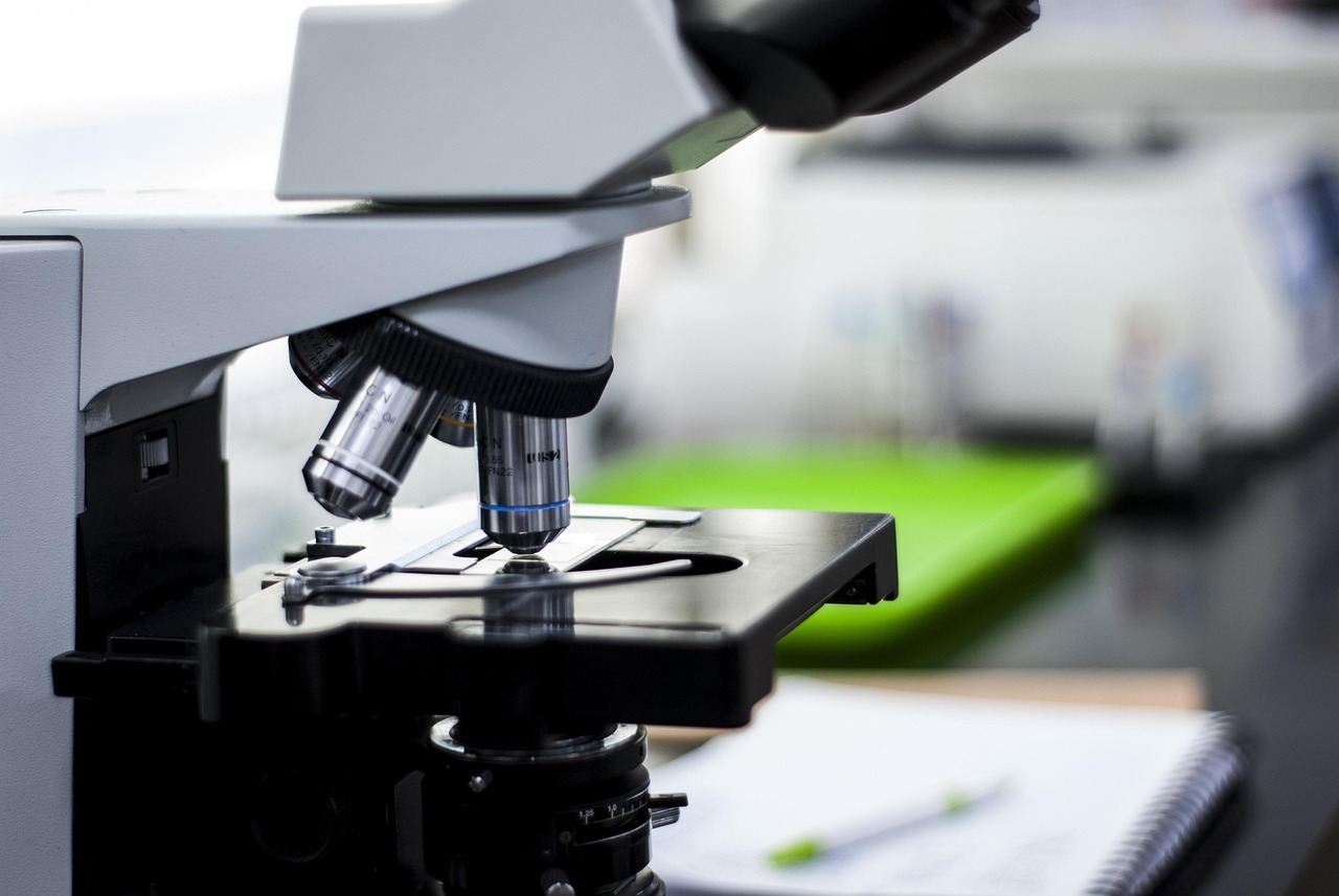 현미경으로 혈뇨 확인하는 잠혈상태