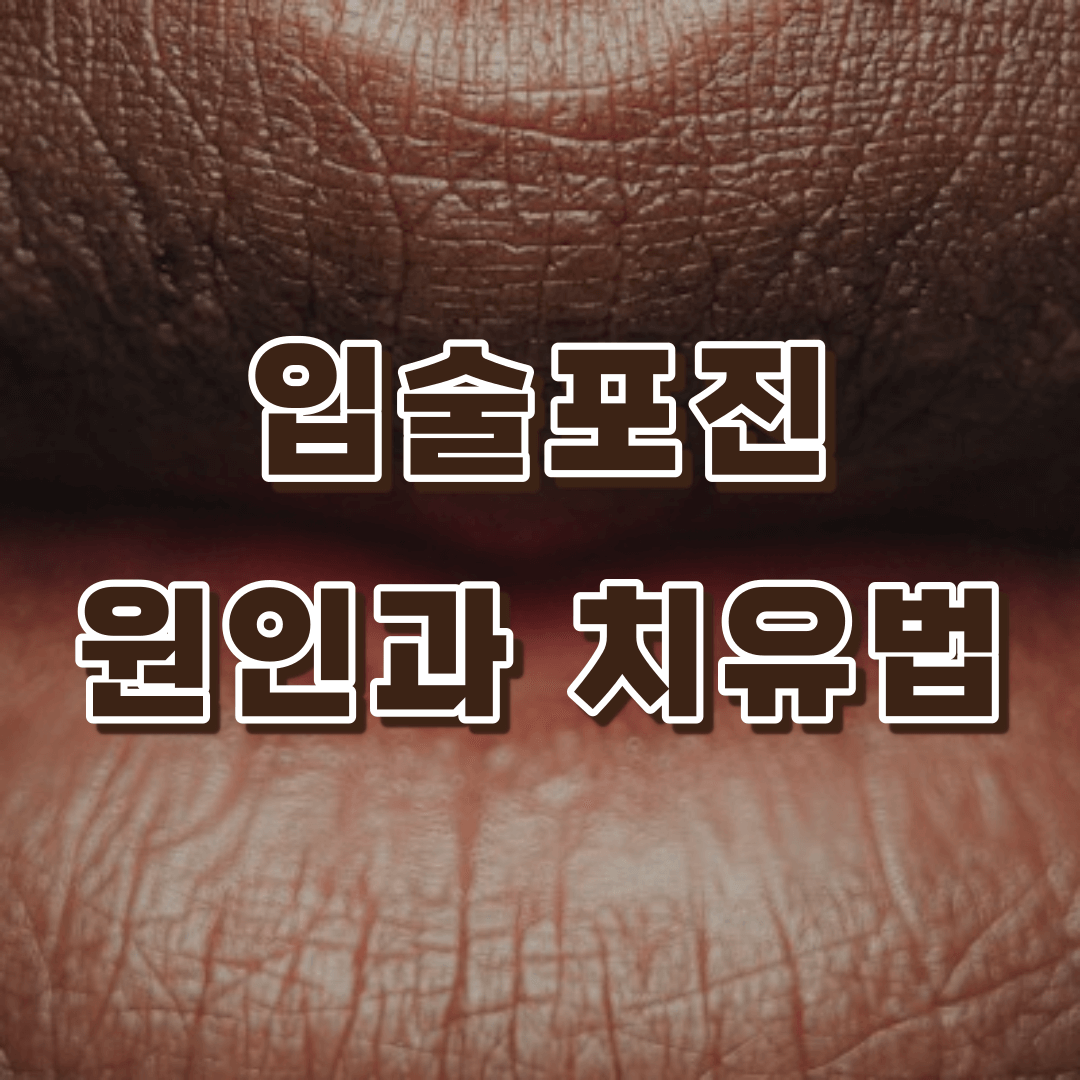 입술포진 원인과 치유법