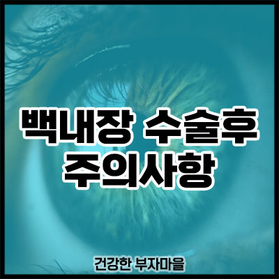 백내장 수술후 주의사항