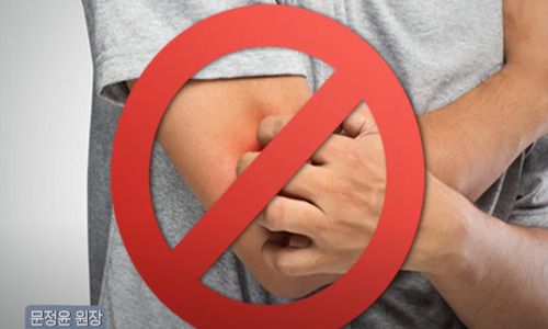 겨울철 피부 보습