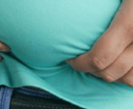 고지혈증증상비만