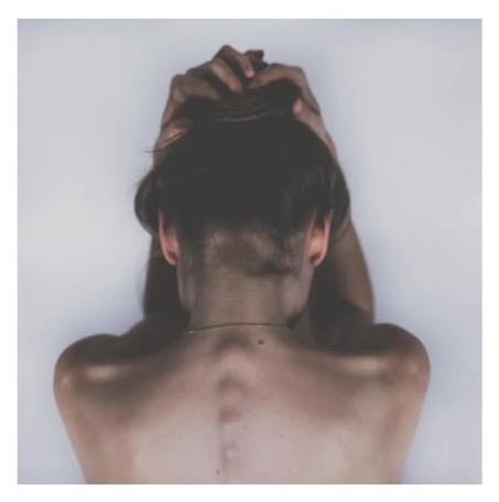 스틸녹스 부작용 두통 이미지