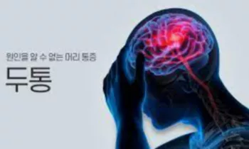 두통