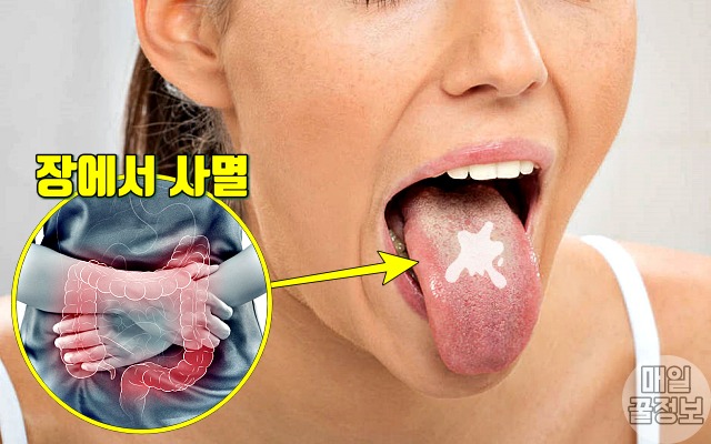 가래 색깔별 증상, 투명한 가래색깔, 건강 팁줌 매일꿀정보