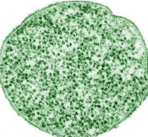 유레아플라즈마 파붐2