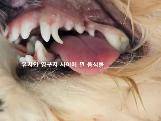 잔존유치 문제점