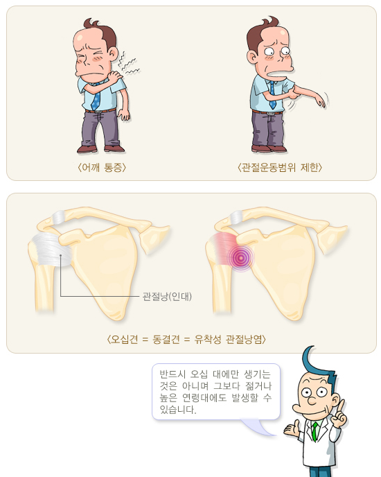 오십견