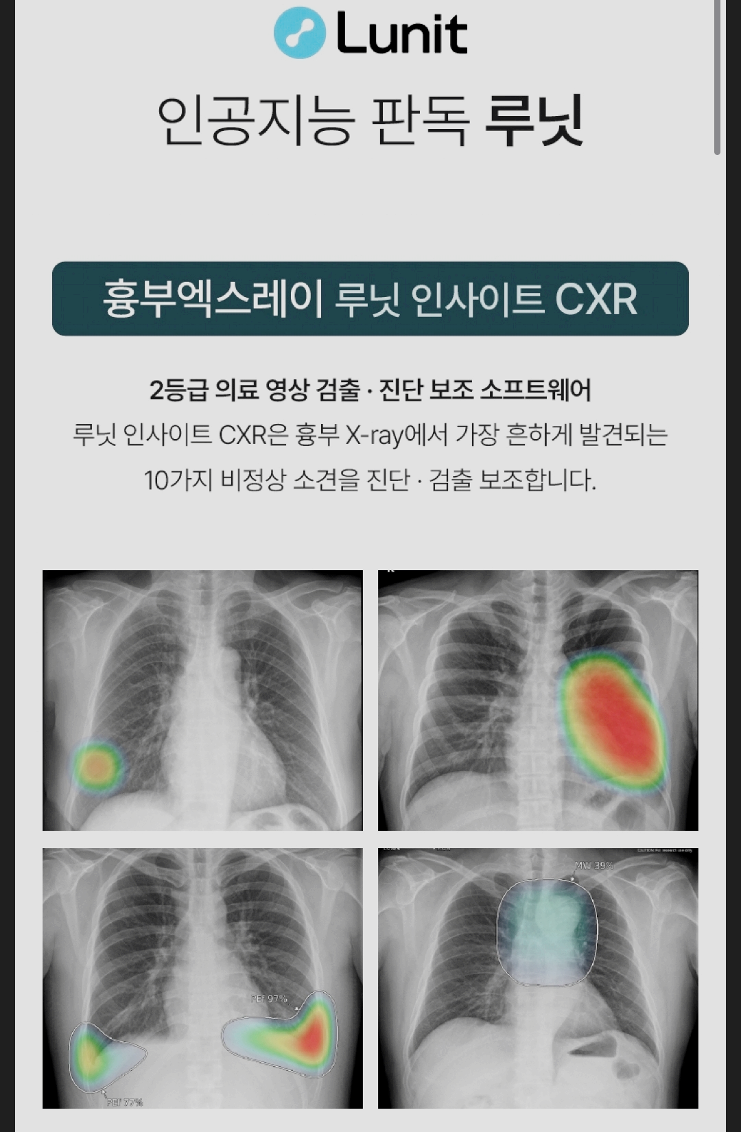 ai건강검진
