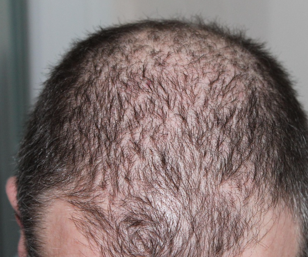 케라넷(Keranet)이란 무엇인가?