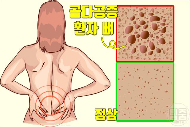 대추 매일 먹으면 3개 대추효능 골다공증 뼈