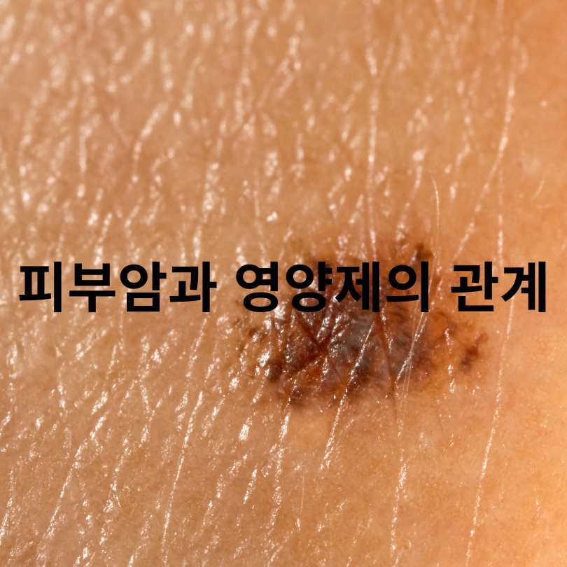 피부암 예방에 좋은 영양제