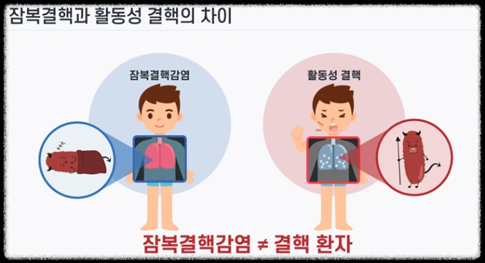 잠복결핵_활동성결핵환자차이