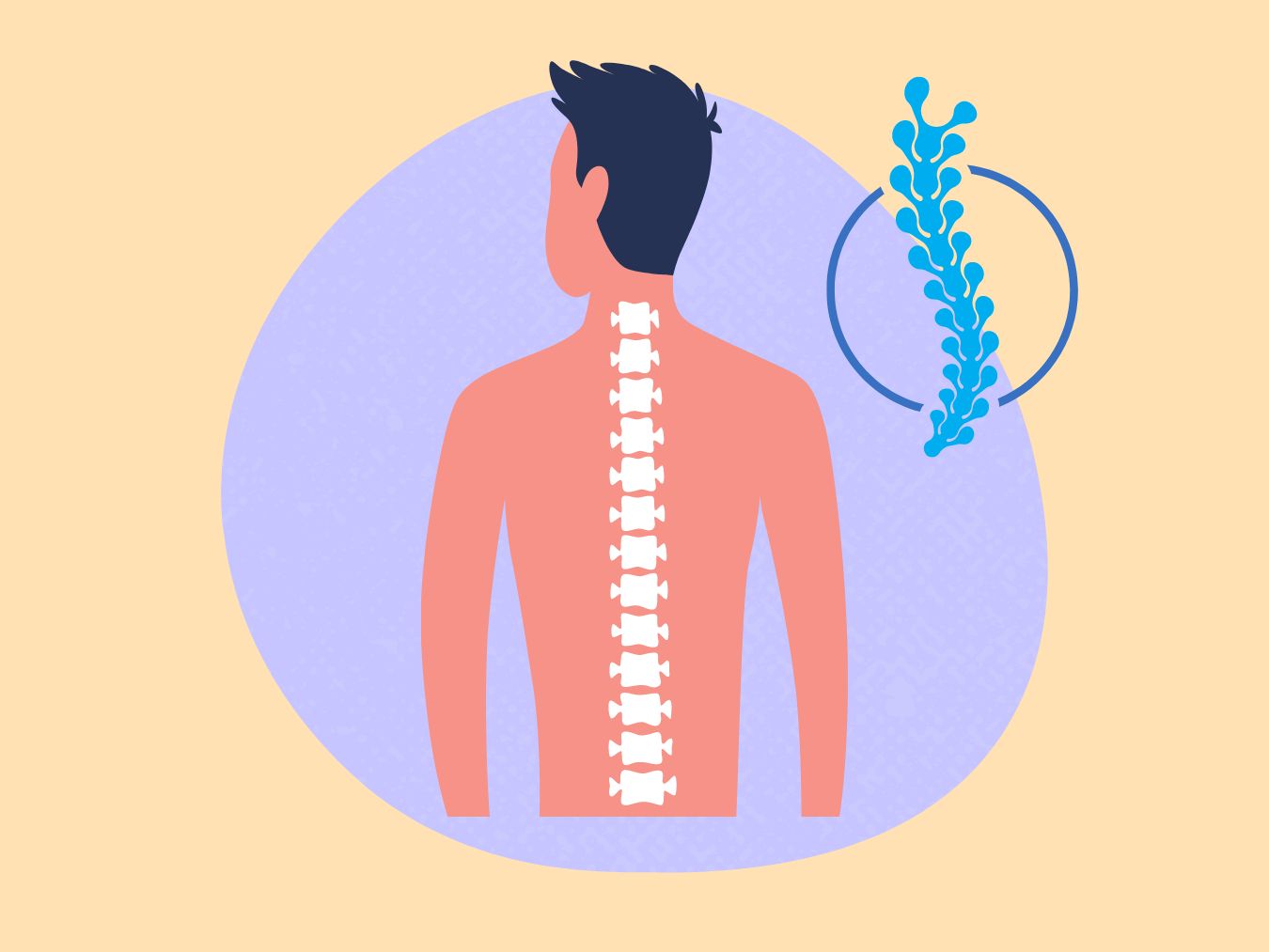 카이로 프랙틱 효과