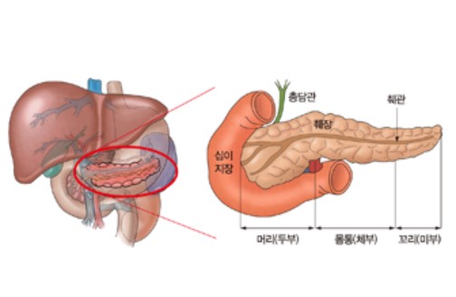 췌장 위치