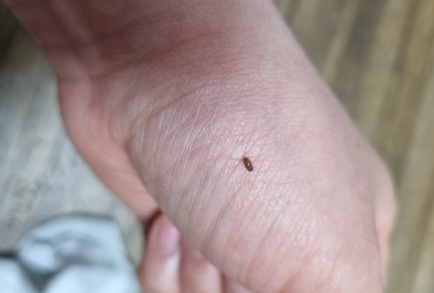 권연벌레 서식지 생기는이유 살충제 방역 퇴치법 물린자국 증상 치료방법 총정리2