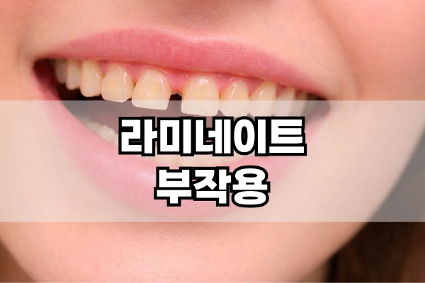 라미네이트 부작용