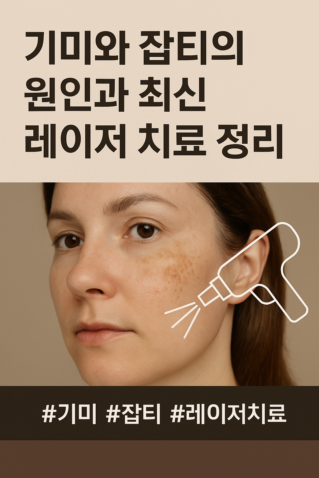 40대 기미와 잡티의 원인과 최신 레이저 치료 정리