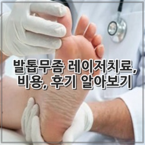 발톱무좀 레이저치료, 비용, 후기 알아보기