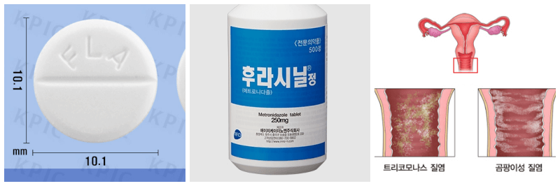 후라시닐정, 질염 사진