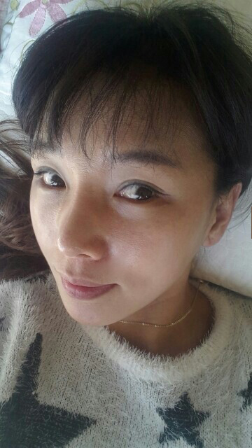 상안검 수술 후기