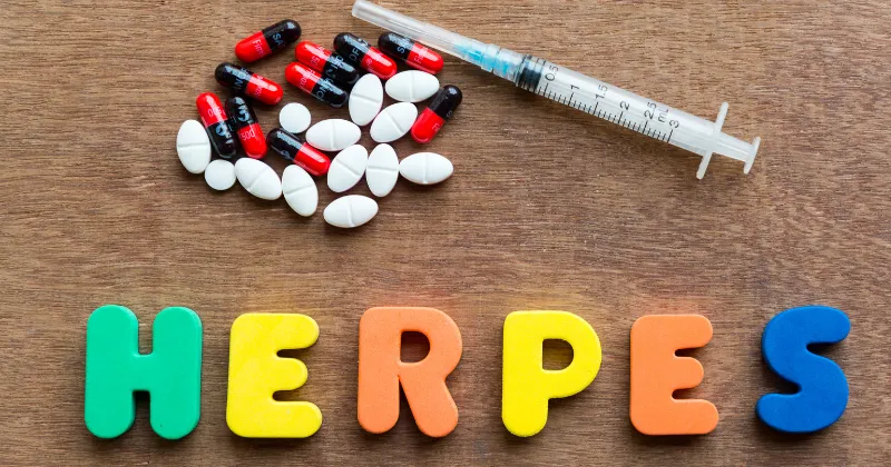 헤르페스 치료