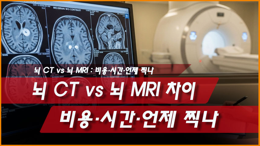 뇌 CT vs 뇌 MRI 차이: 비용&middot;시간&middot;언제 찍나 (표로 정리)