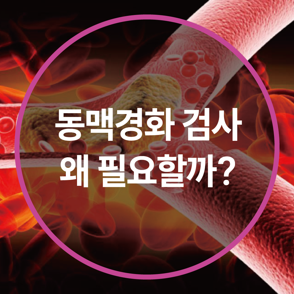 동맥경화 검사, 왜 필요할까? 검사 방법과 비용 총정리