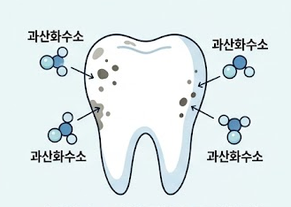 셀프-치아미백기계-내돈내산-효과-원리-부작용-추천-제품