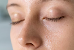 신장이 안좋으면 나타나는 증상 3