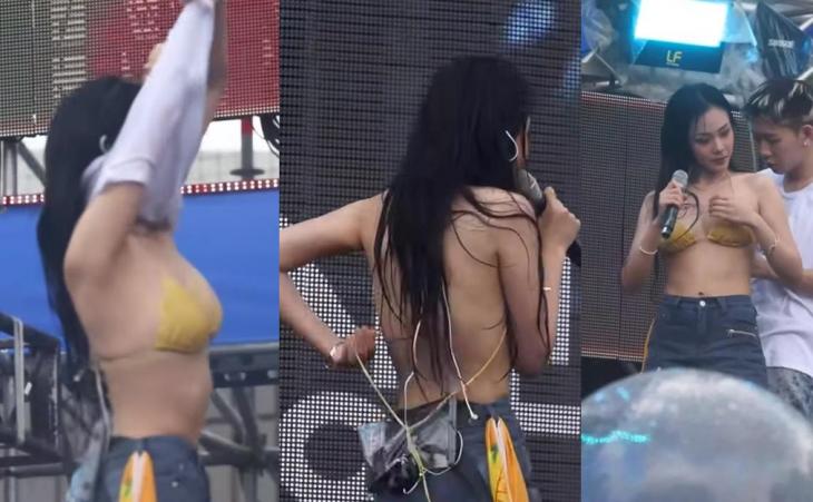 비비 노출