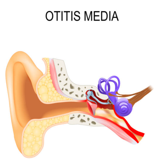 이석증과 관련된 사진3