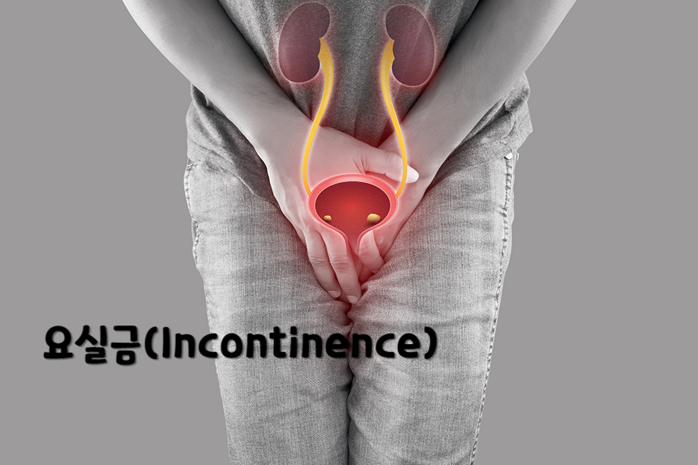 요실금(Incontinence)