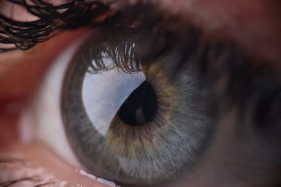 라식/라섹 기반 노안교정술 (PresbyLASIK)