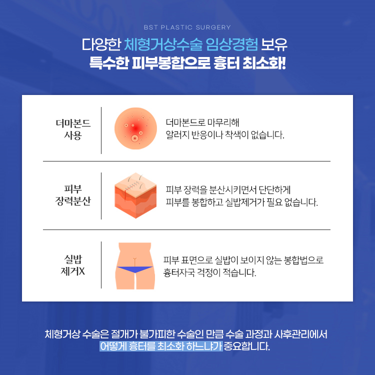 다양한 체형거상수술 임상경험 보유
특수한 피부 봉합으로 흉터 최소화!